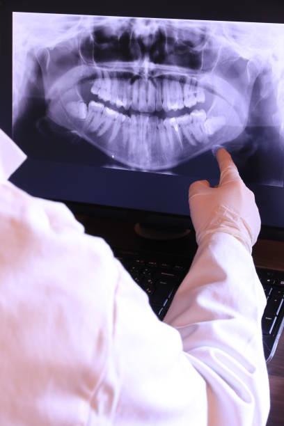 Best Emergency Dentist for Knocked-Out Tooth in Tuscola, IL