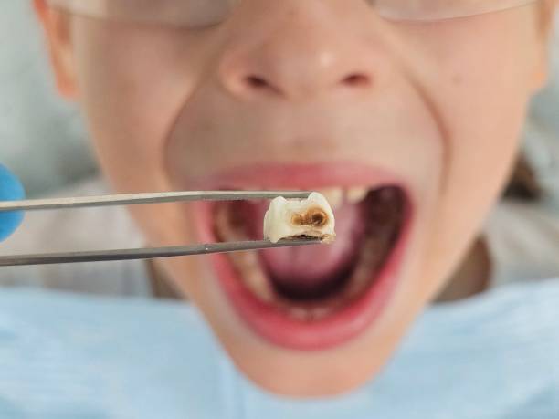 Best Weekend Emergency Dentist in Tuscola, IL